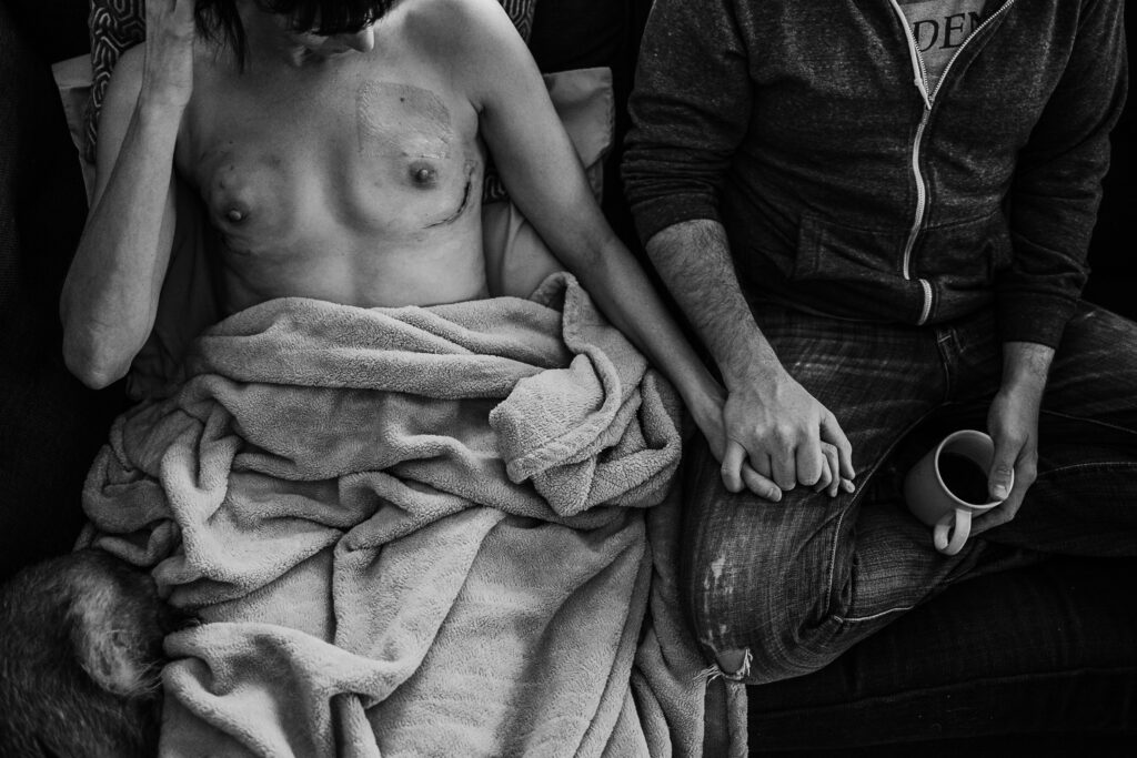 A couple holds hands after a preventative mastectomy